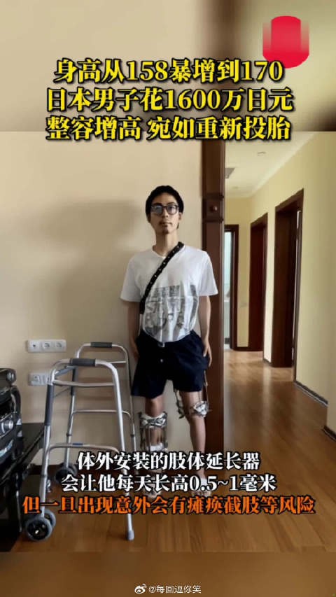 男子花1600万日元整容增高 ，身高从18暴增到170，宛如重新投胎