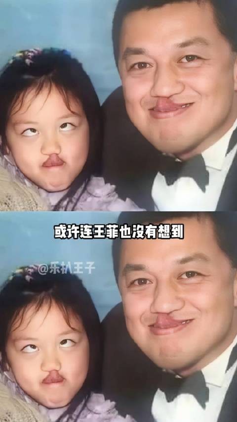 李嫣18岁近照曝光,历经4次手术蜕变成长