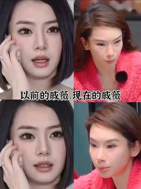 为啥女明星都热衷于调整脸部~ 真的是为了 beauty 不惜一切吗?
