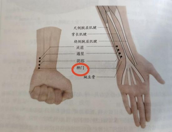 图中标红为神门穴。（受访者供图）