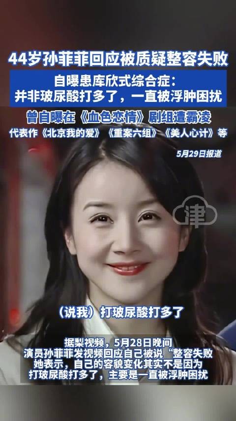 孙菲菲回应整容质疑，自曝患库欣式综合症