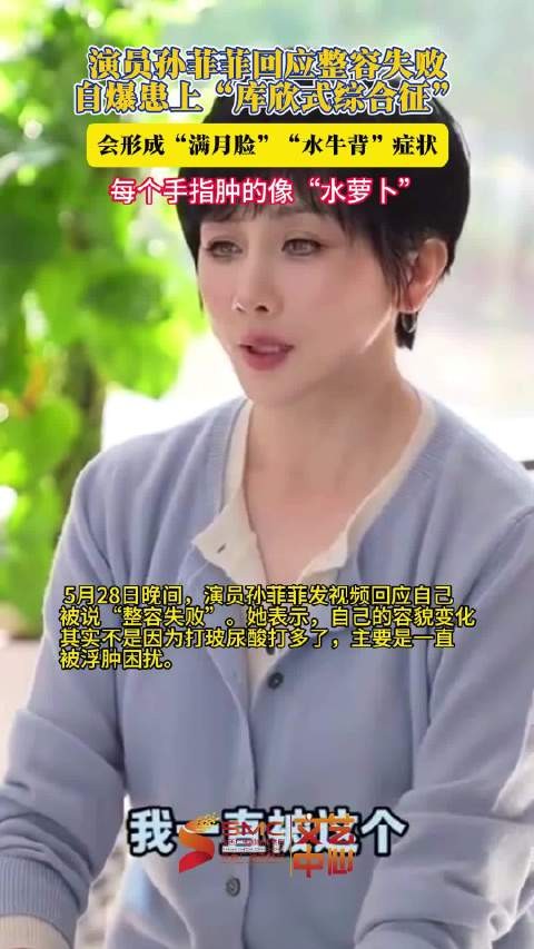5月28日晚间,演员孙菲菲发视频回应自己被说“整容失败”