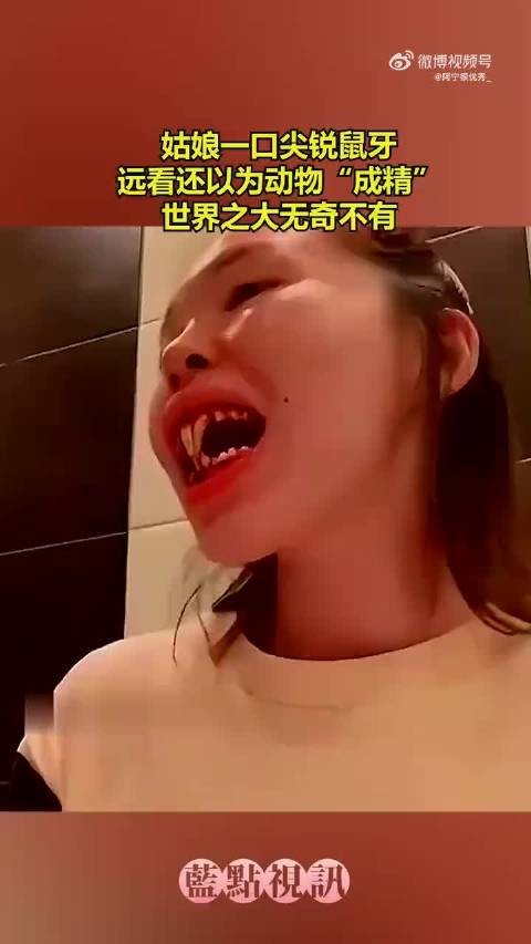 姑娘一口尖锐鼠牙，远看还以为动物“成精”，世界之大无奇不有