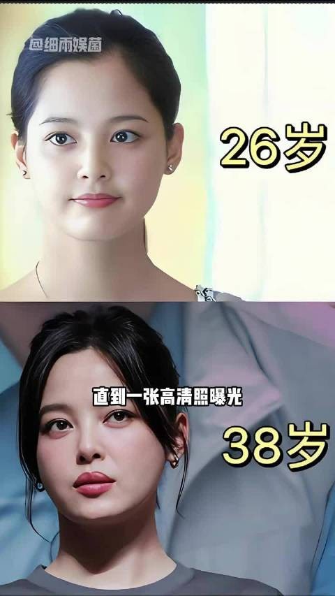 为何辛芷蕾从樱桃小嘴变成“三瓣唇”？一张高清照曝光，原来是我们格局小了