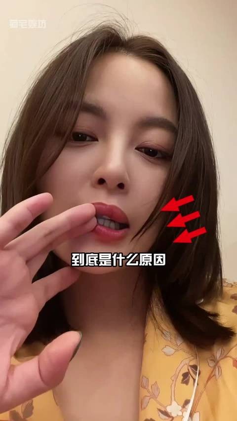 明明早年好端端的，为何辛芷蕾的嘴唇越来越厚？真相曝光才知是女星的爆红之路