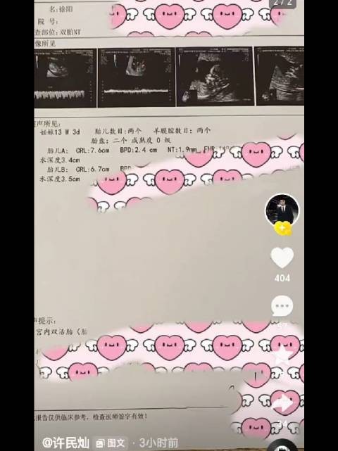 许民灿跟曲肖冰离婚没多久就又找了女朋友，昨晚官宣女朋友怀孕，还是双胞胎