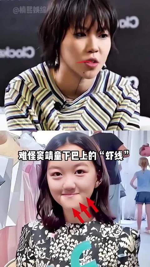 为何窦靖童的“虾线”与李嫣的“兔唇”会一同消失？