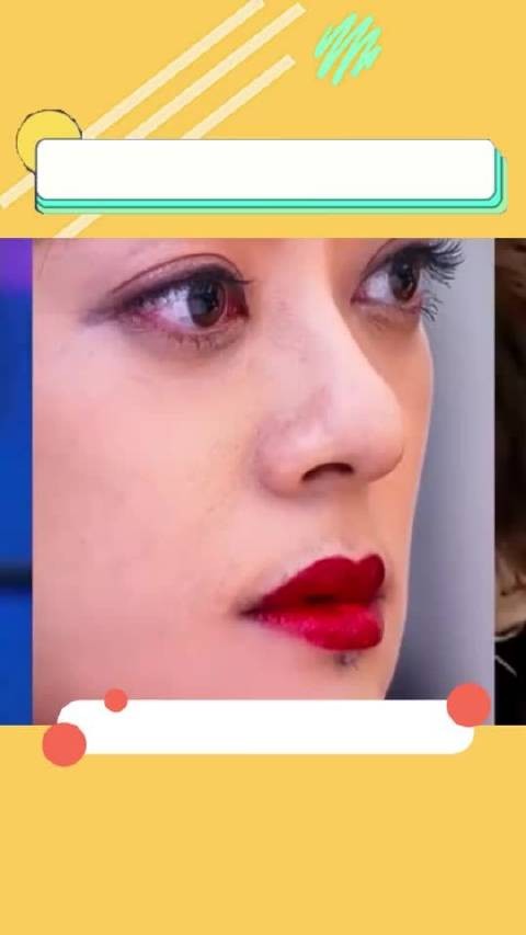 很多人不知道孙俪下巴这颗痣并不是天生就有的