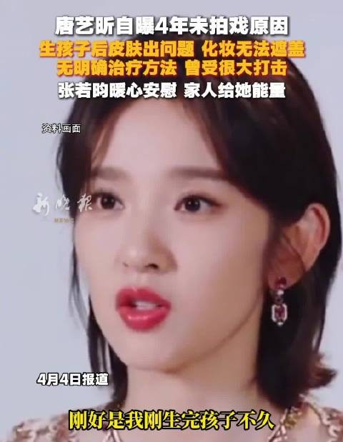 唐艺昕曝4年未拍戏因产后皮肤问题，张若昀暖心支持