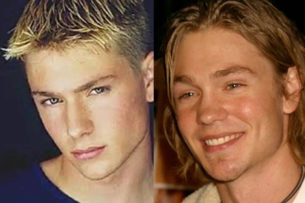 他的鼻子变丑了,反而成为了模特演员