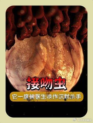 豪斯医生:脸上被“亲”后心脏停跳,这竟不是恐怖片!
