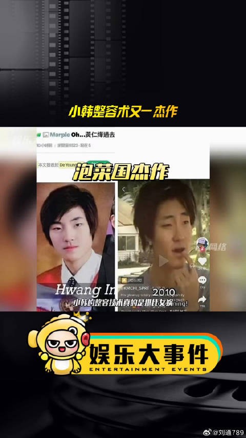 小韩整容术又一杰作，黄寅烨变脸后演上了男二女神降临 医美整容 微博VC计划