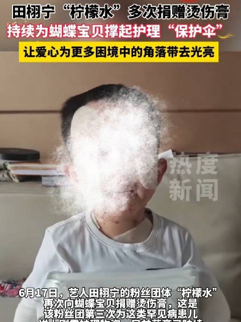 田栩宁粉丝为蝴蝶宝贝捐赠烫伤膏