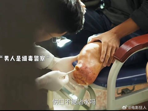 因为一个片段追完整部剧clet