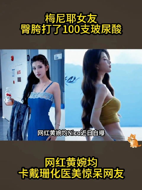 梅尼耶女友臀胯又打了100支玻尿酸,网友:审美逐渐卡戴珊化 ?