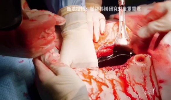 手术台上的暧昧？ 在病人体内拉小手？ 地狱剧情啊！