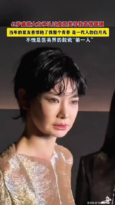41岁戚薇出席活动承认医美后脸部僵硬