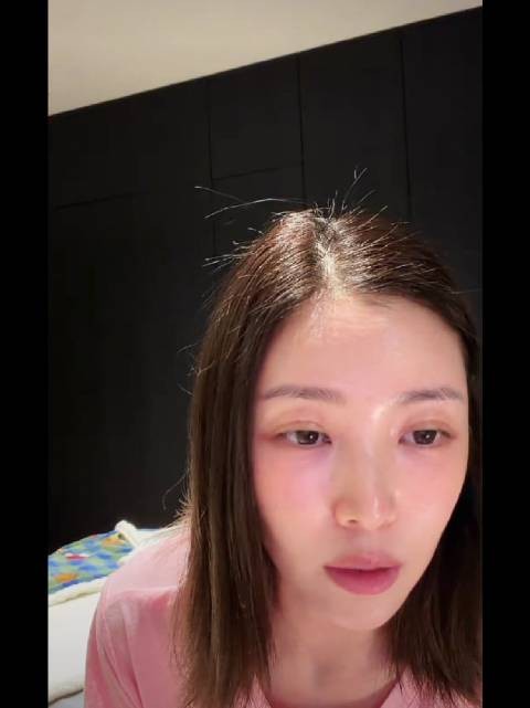 王灿自曝自己是比较严重的疤痕体质,不会轻易do的!